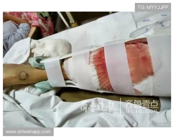 户外大石头上跳跃导致粉碎性骨折 让人不禁感叹愚蠢行为引发的惨痛后果